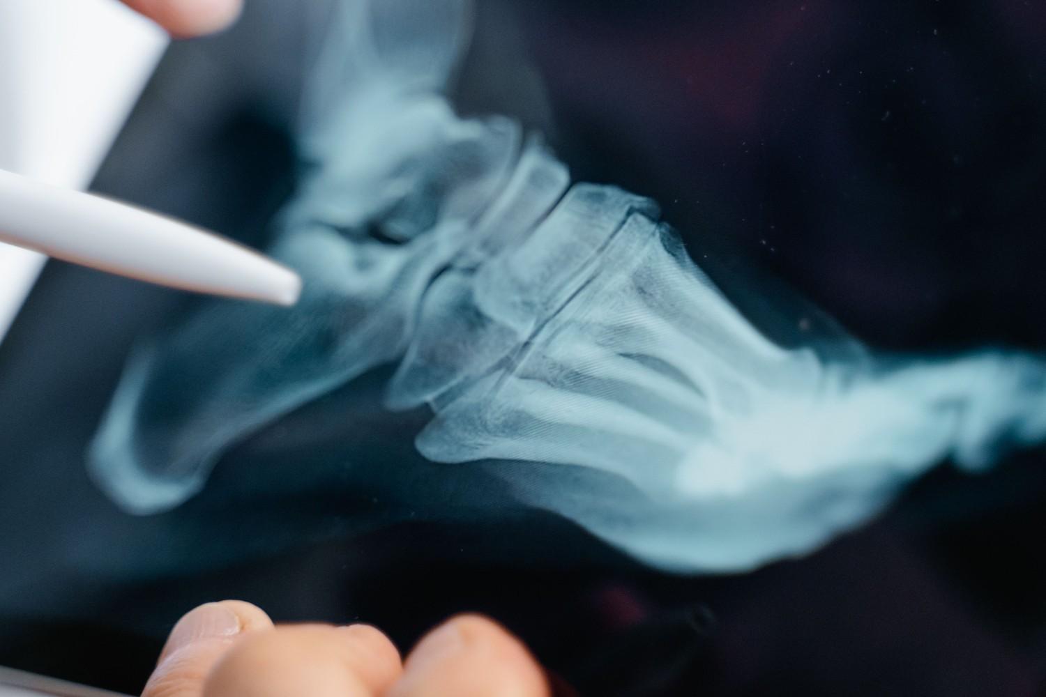 Digital X-Ray in Abu Dhabi