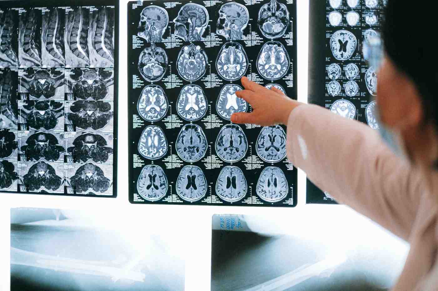 MRI in Abu Dhabi