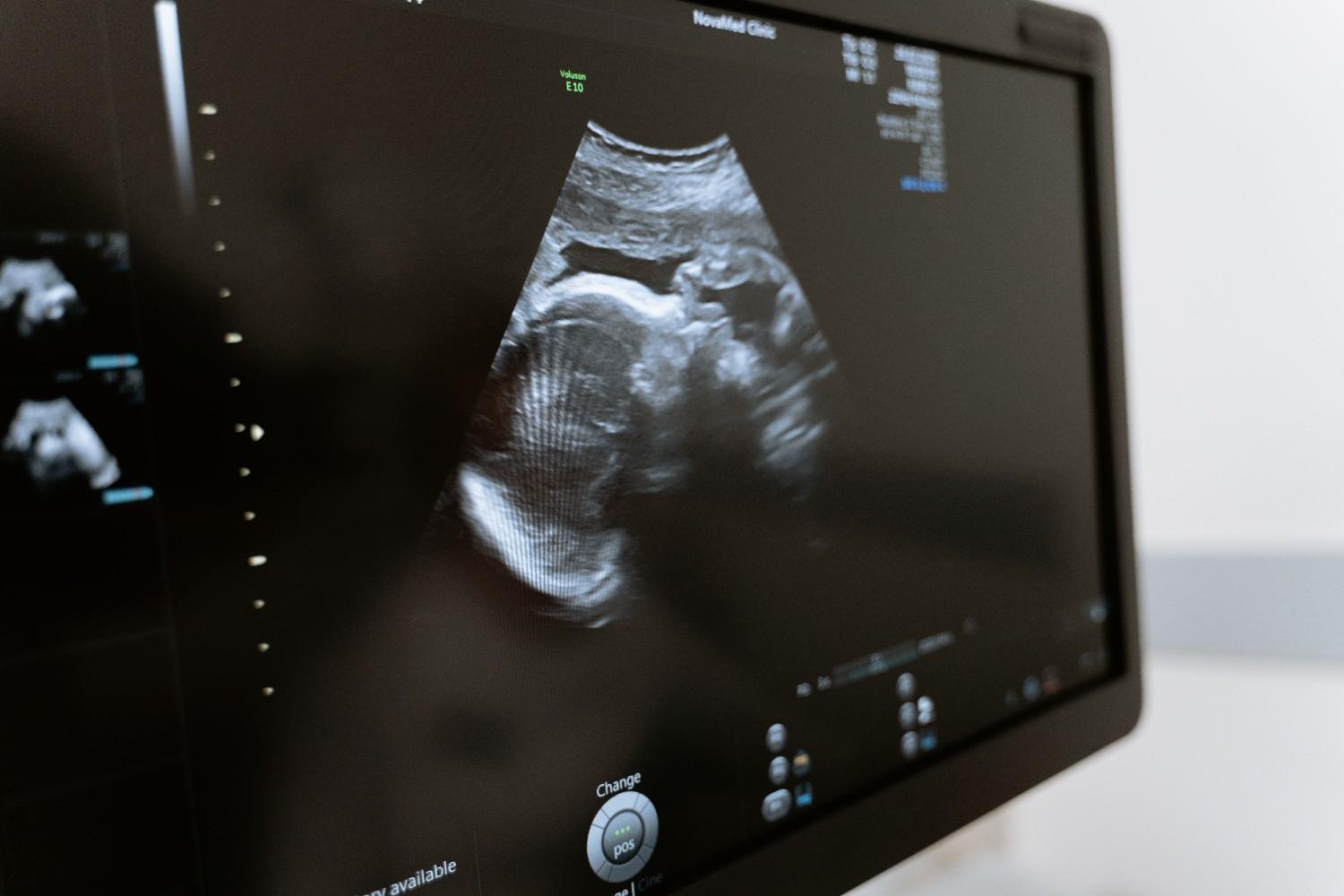 Ultrasound in Abu Dhabi